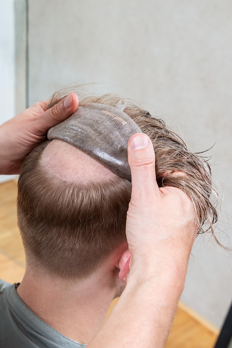 DENING HAIR GmbH | MT Kolja__Micro_Skin